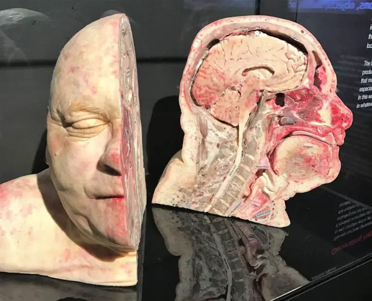 Cutaway human head